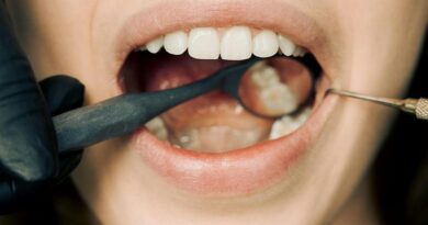 De ce nu e niciodată prea târziu pentru un aparat dentar